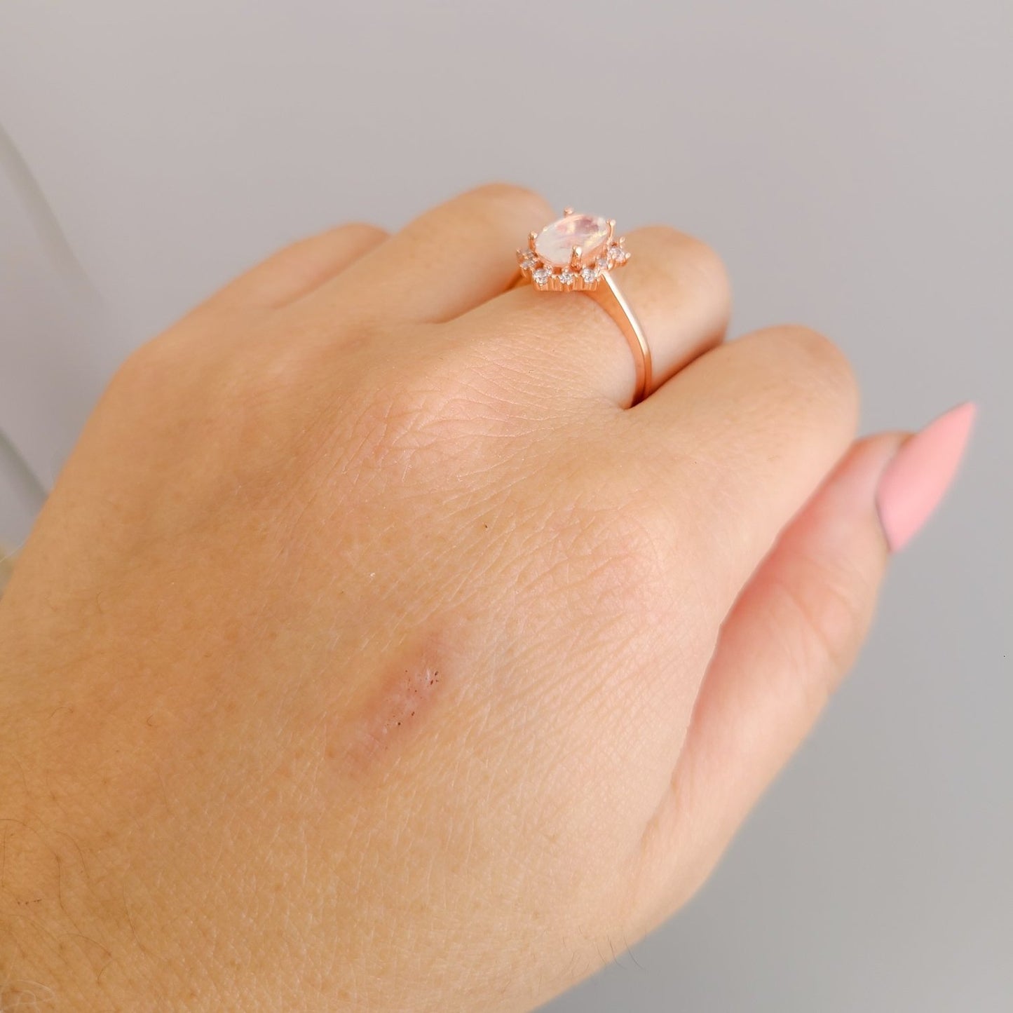 Lacy Ring